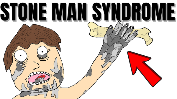 Disease That Turns Your Body Into Stone