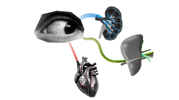 How Your Eyes Help Us Diagnose Certain Conditions