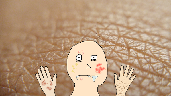 Why I won’t specialize in dermatology?