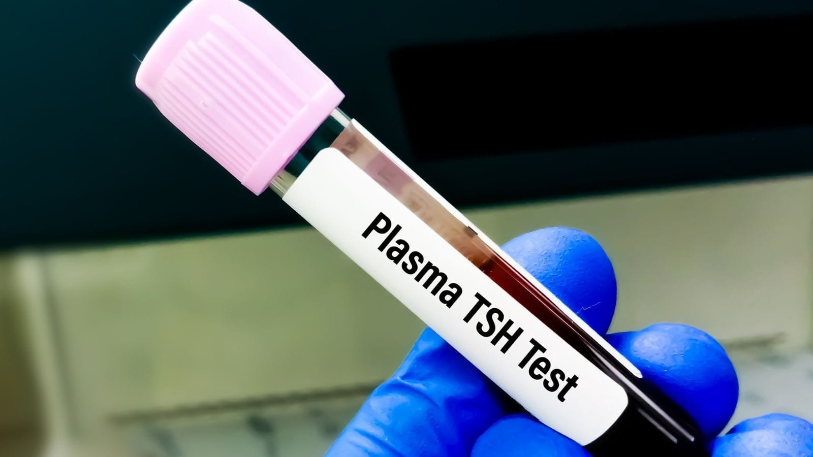 TSH bloedtest