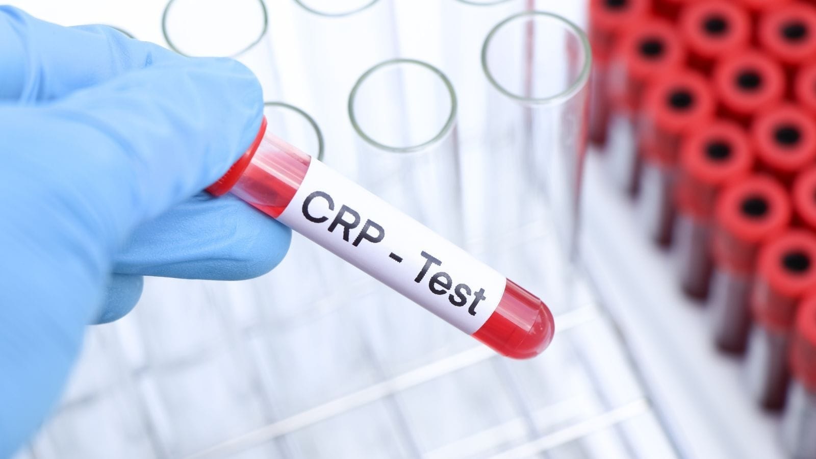 CRP in bloedanalyse