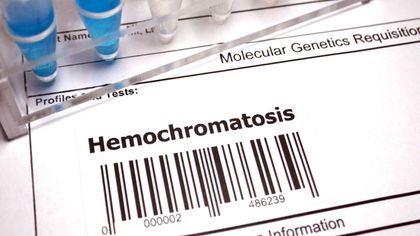 Hemochromatose