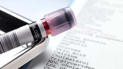 Wat de cholesterolcijfers in je bloed je leren