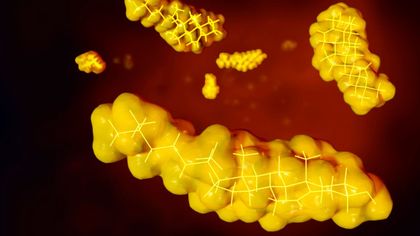 Cholesterol-labo-decoder (LDL, ApoB, Lp(a))