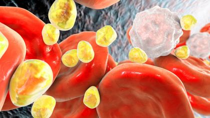 Wat is een goede cholesterolwaarde?