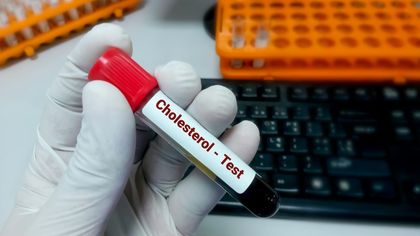 Cholesterol en de menopauze: waarom je waarden stijgen na je 45ste