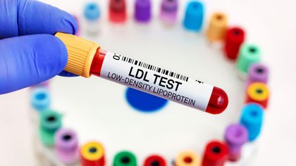 Twee onbekende cholesterolwaardes die je wil kennen