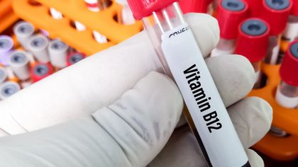 Wat zegt B12 zonder homocysteïne?