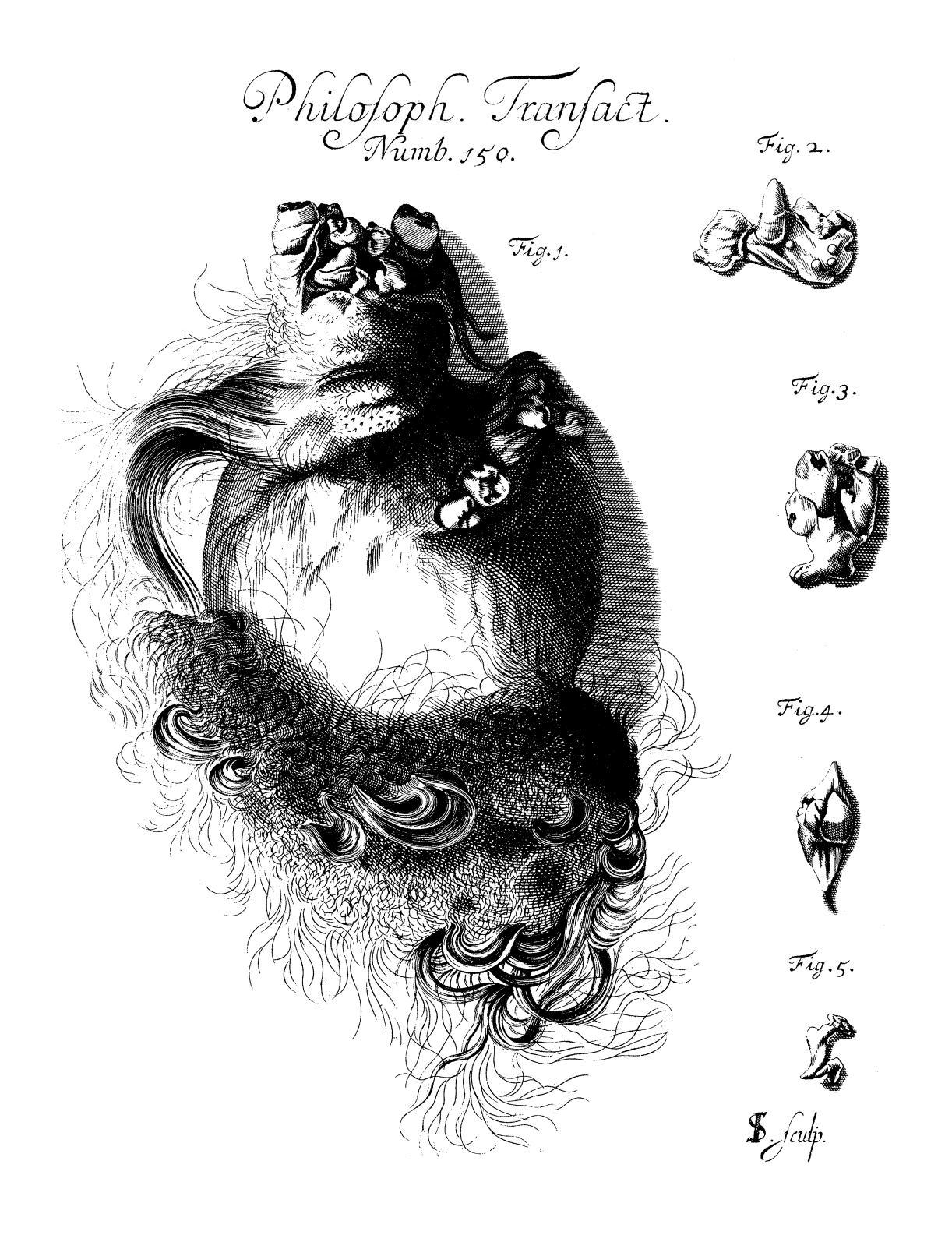 Philosophical Transactions - An Account of an Extraordinary Birth in Stafford-shire