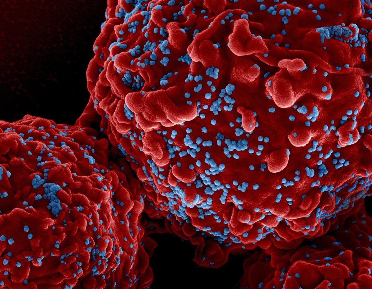 O pastilă nouă pentru HIV a trecut primul test pe oameni, cu rezultate promițătoare