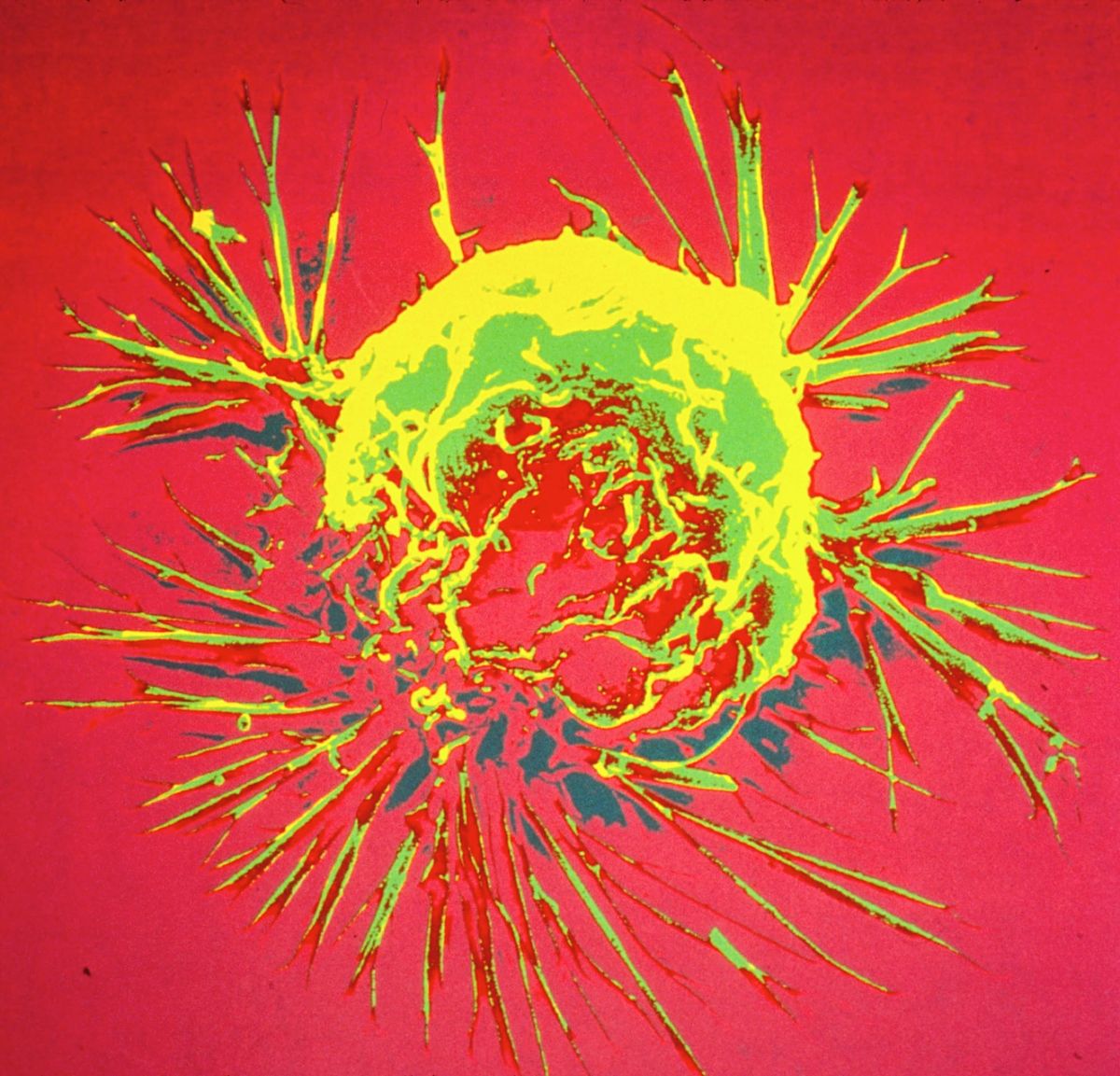 Un medicament oral derivat din bacteriile intestinale a eradicat complet tumorile la șoareci