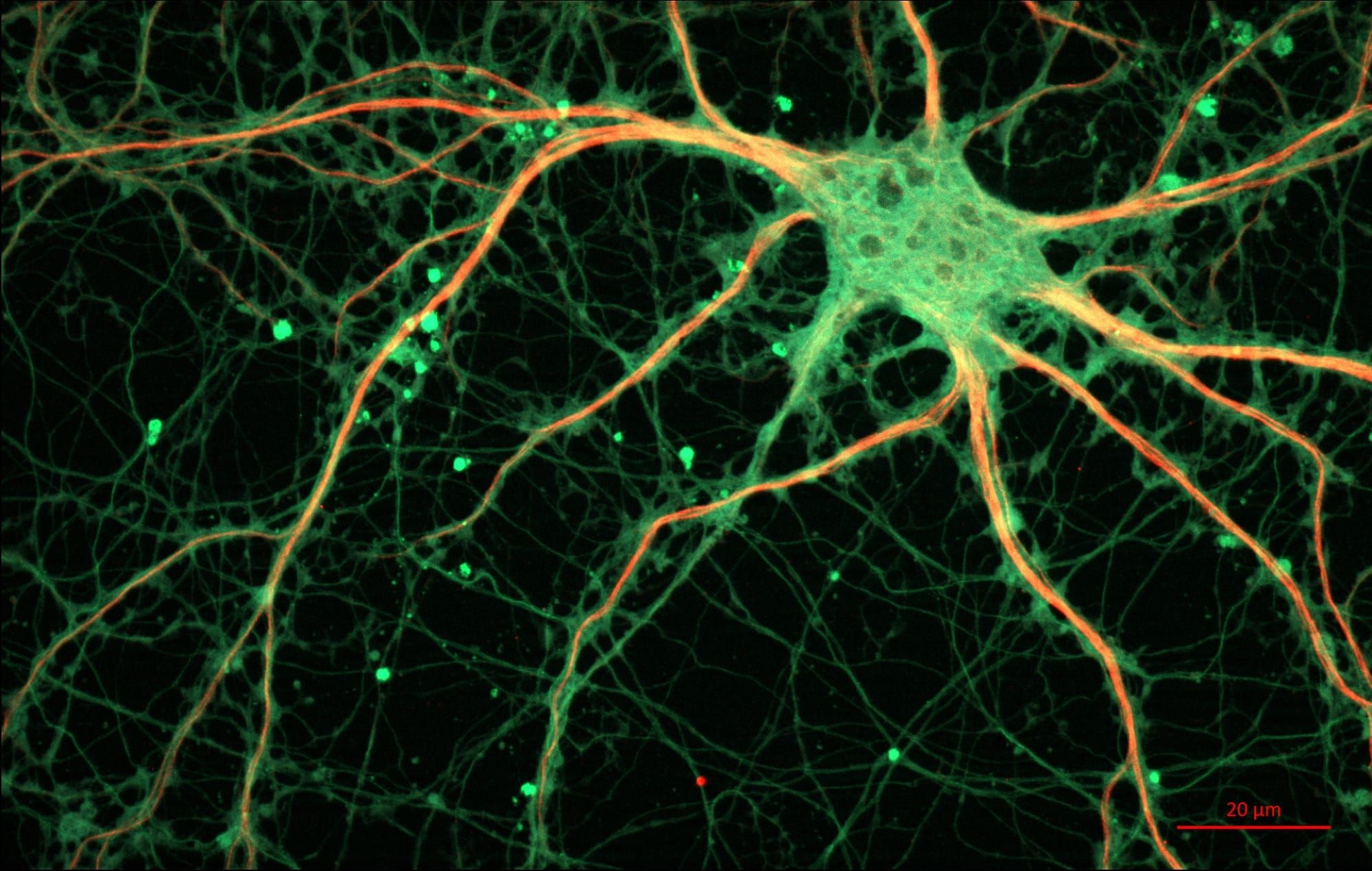 Imagine la microscop cu un neuron de hipocamp și rețeaua sa de prelungiri, colorat fluorescent