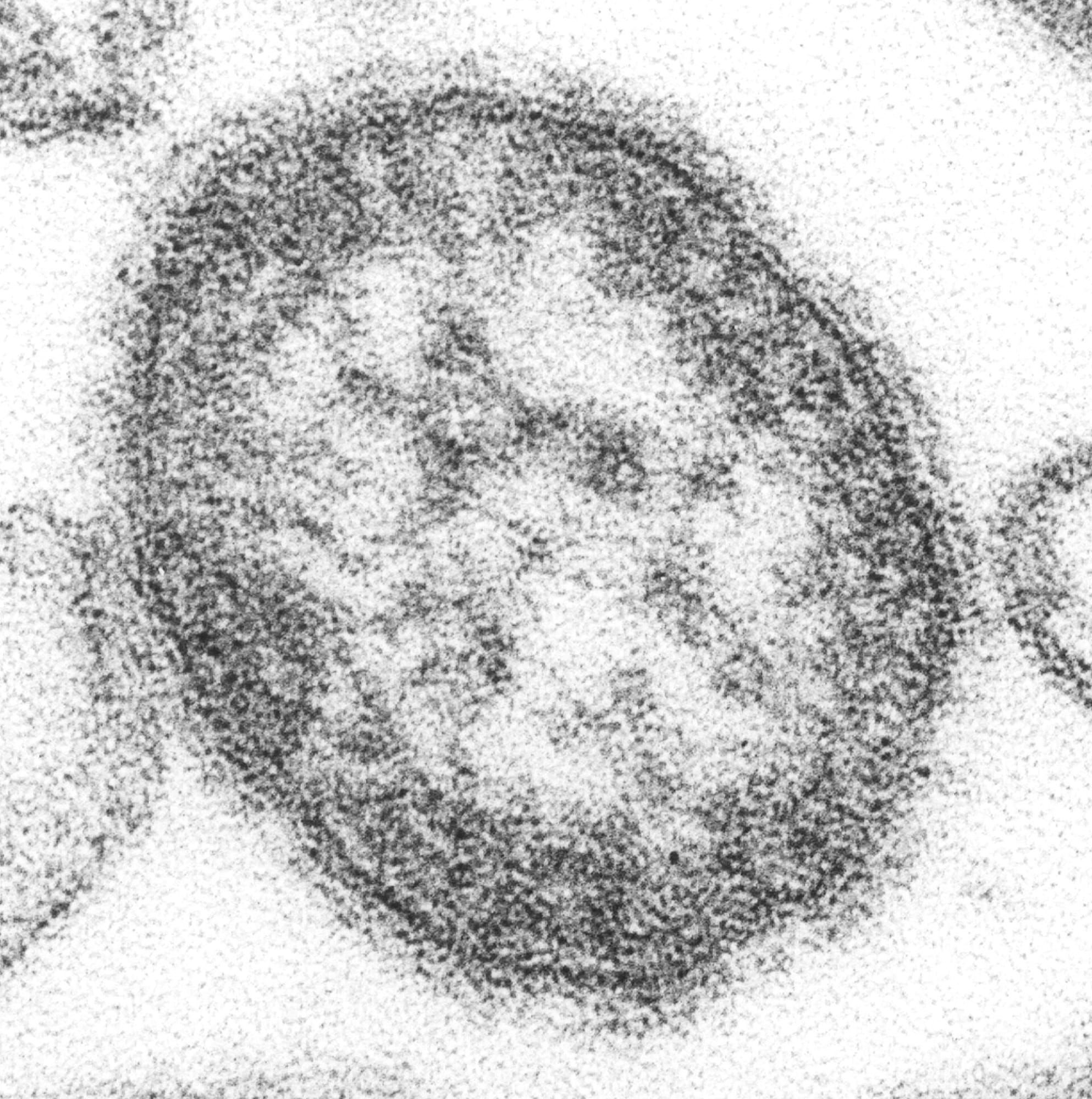 Imagine la microscop electronic a unei particule de virus rujeolic