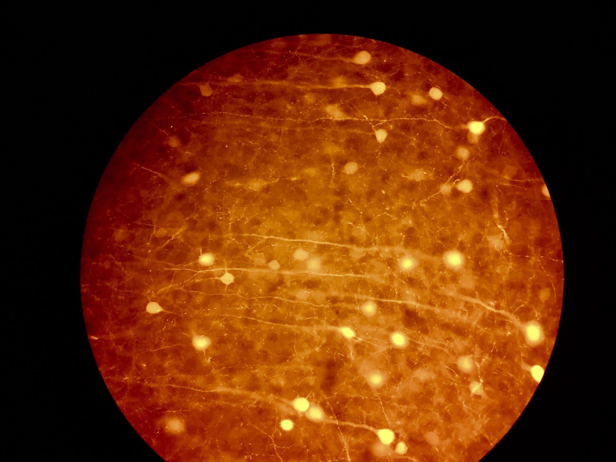 Imagine de microscopie cu fluorescență a neuronilor dintr-un creier de șoarece