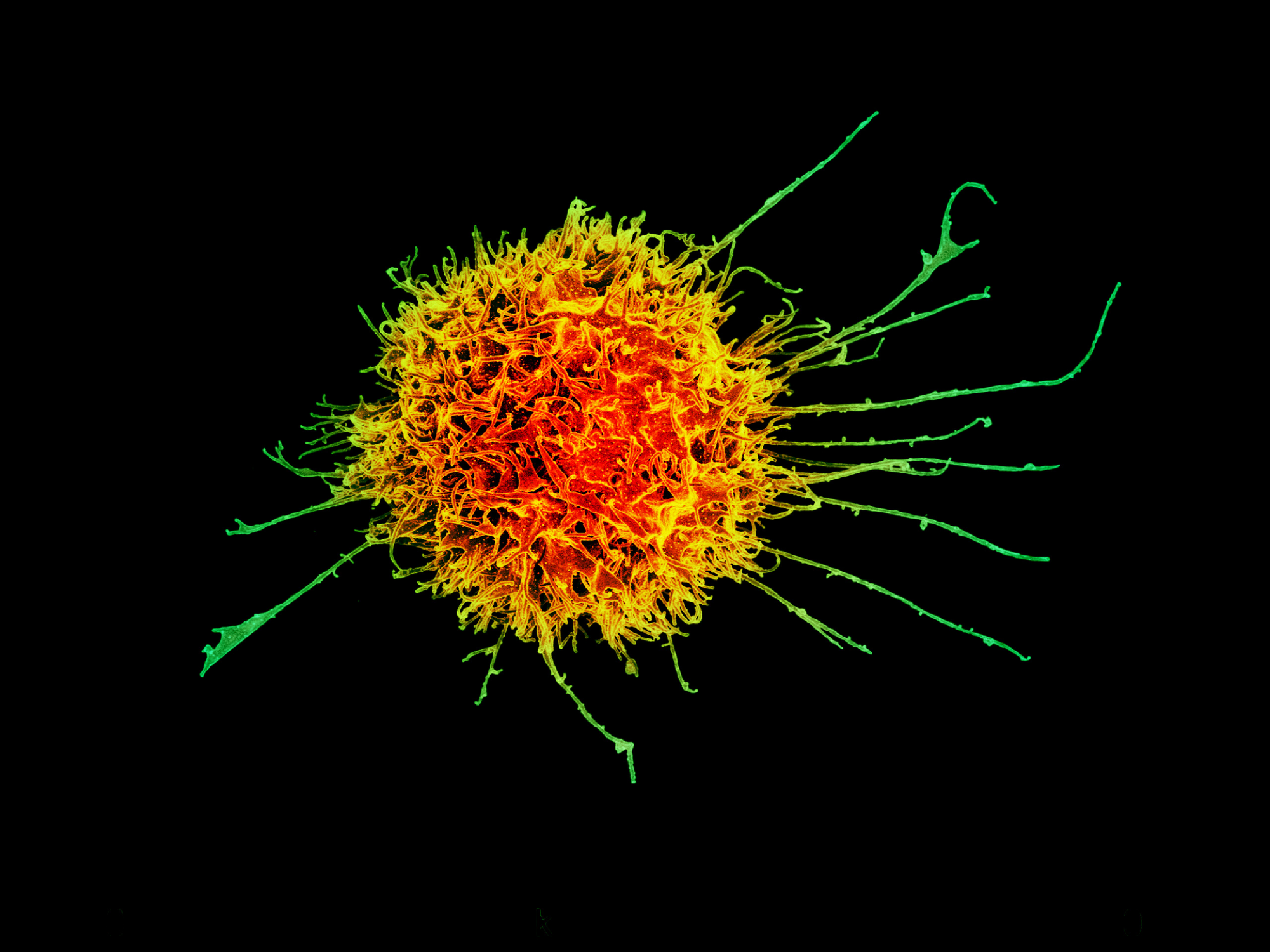 Micrografie electronică color a unei celule natural killer umane