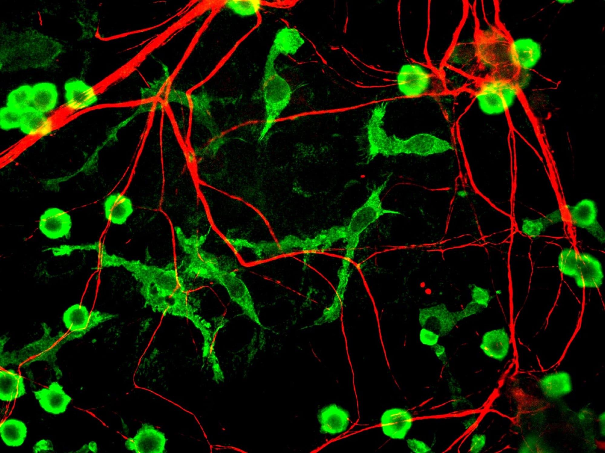 Microglii (verde) printre neuroni (roșu), imagine de microscopie prin imunofluorescență