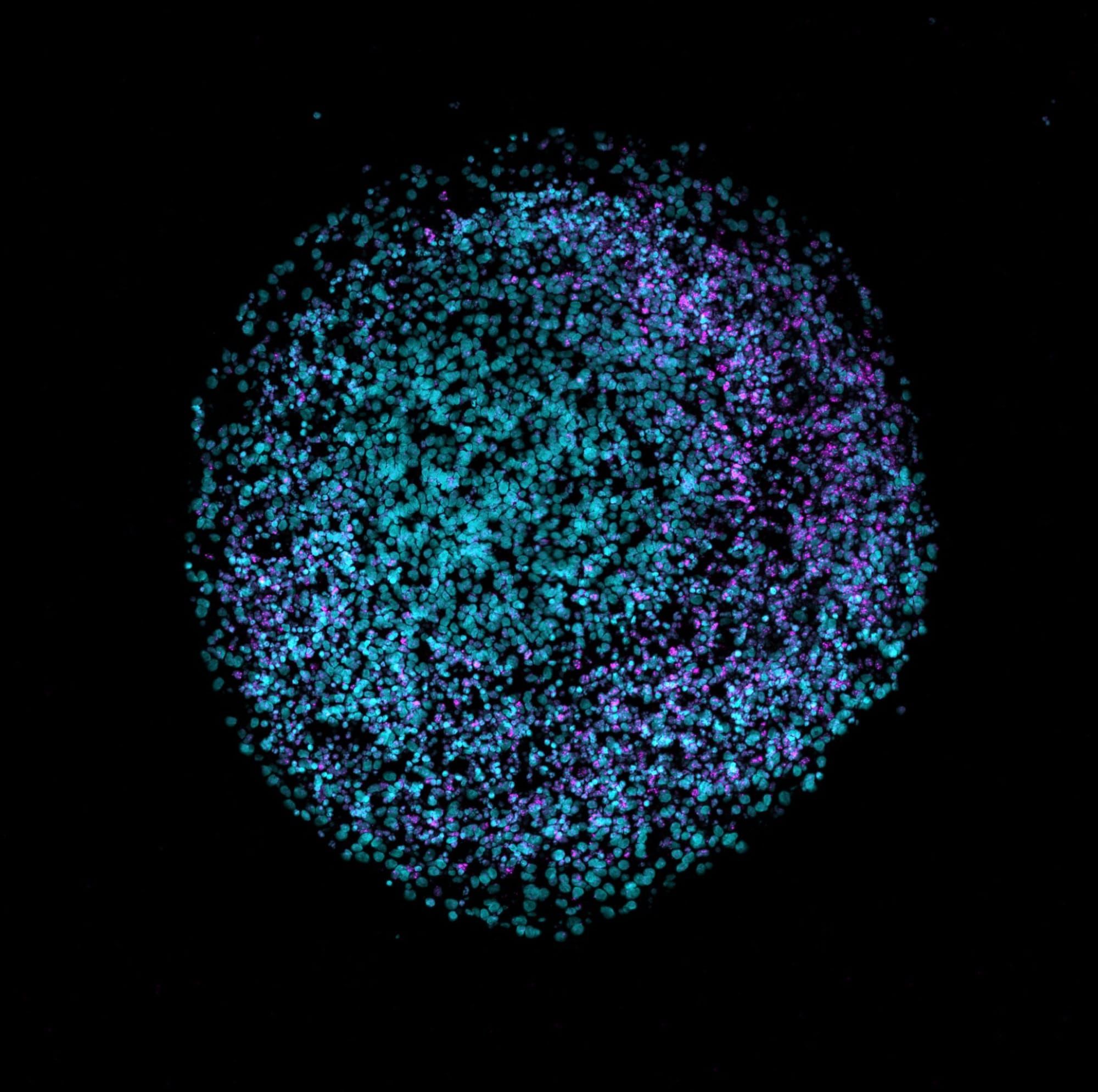 Organoid cerebral uman la microscopia de fluorescență