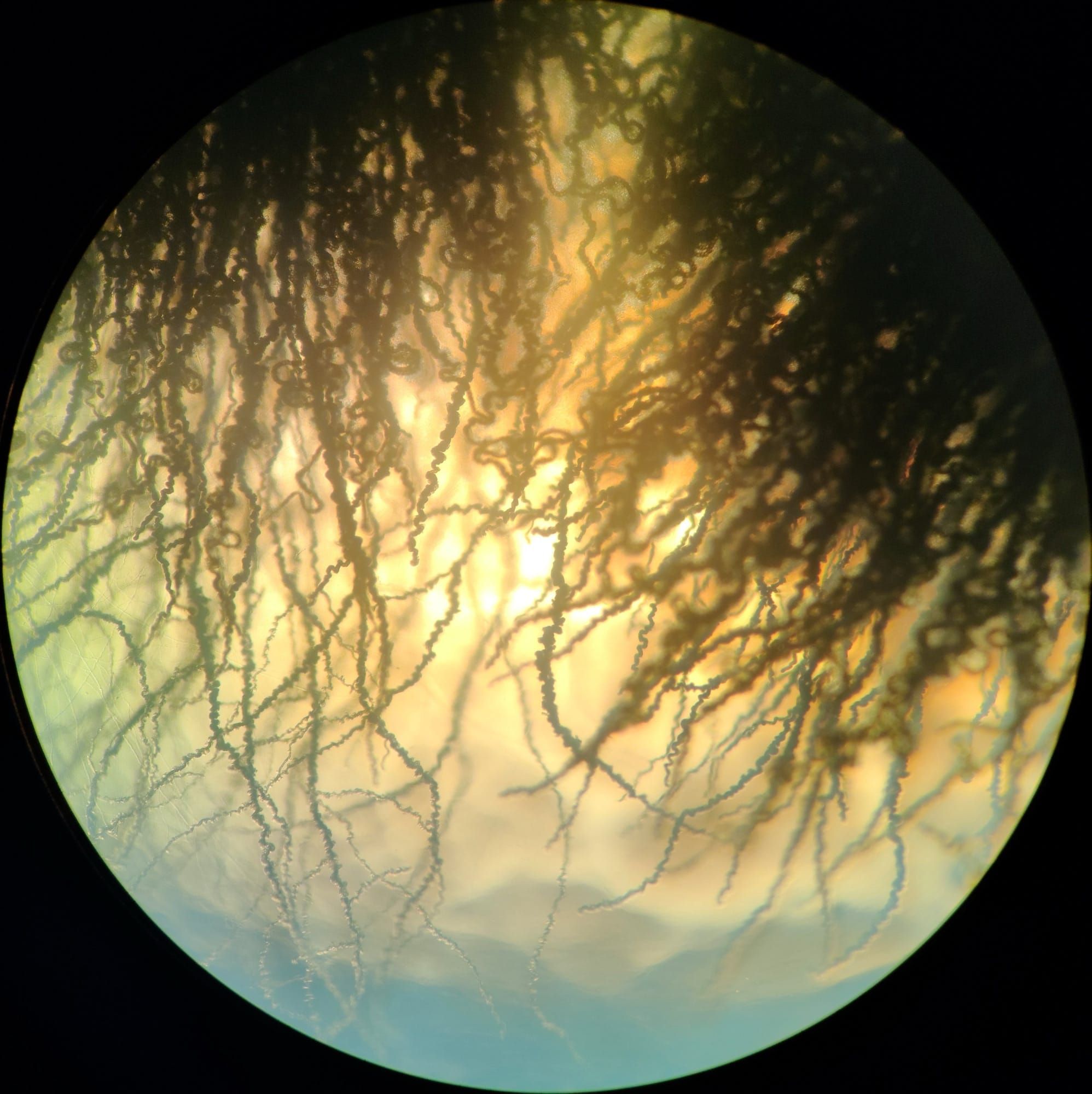 Ciuperca Aureobasidium pullulans vazuta la microscop