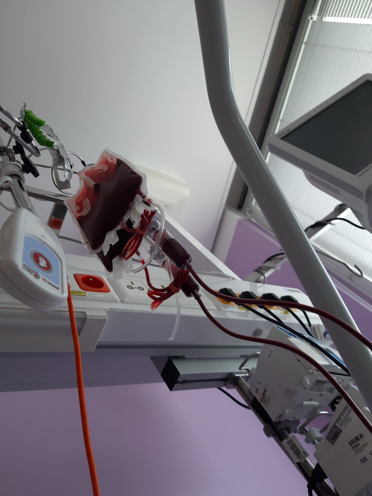 Pungă de sânge conectată la un aparat de transfuzie într-un salon de spital