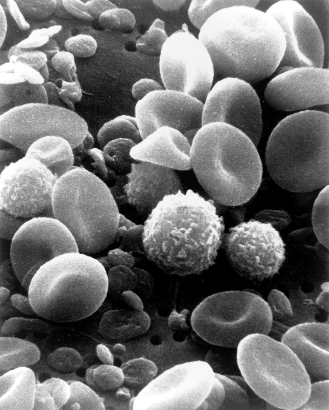 Imagine la microscop electronic cu globule roșii și celule albe din sânge uman