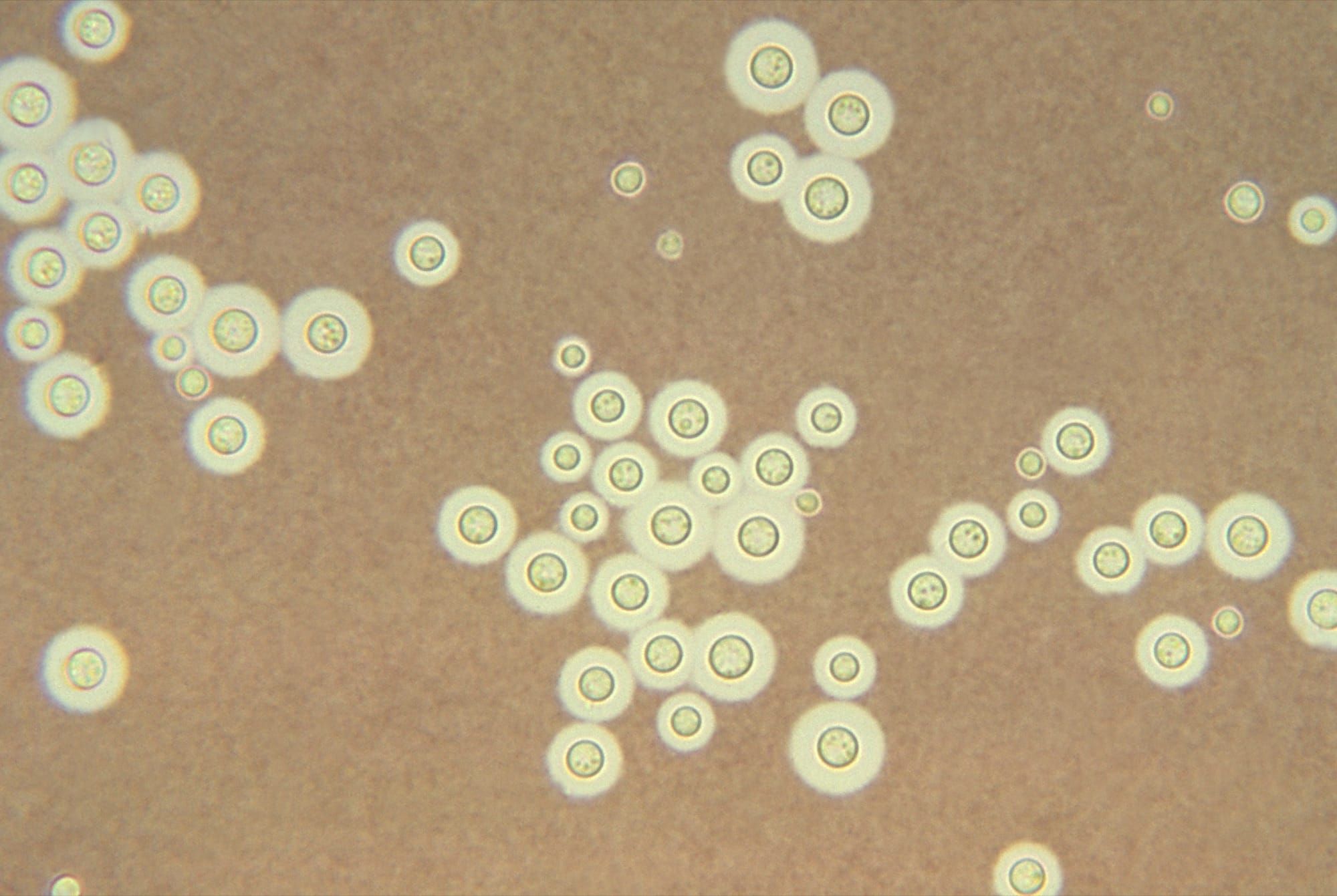 Celule de Cryptococcus neoformans colorate cu cerneală India, la microscop