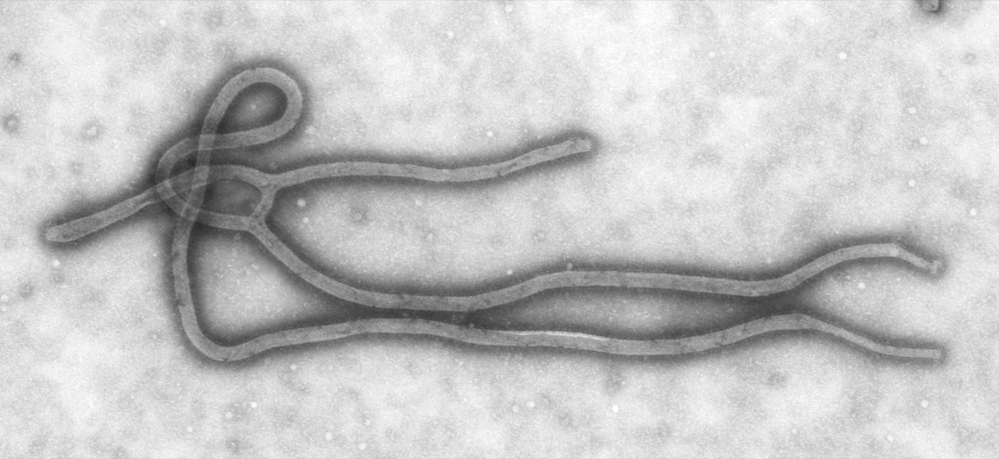 Imagine la microscop electronic a virusului Ebola