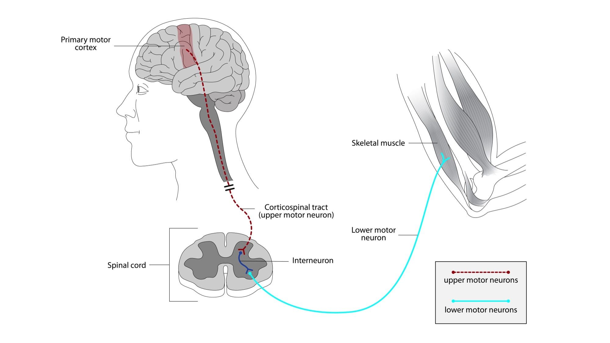 Ilustrație medicală a traseului neuronilor motori, de la cortexul cerebral prin măduva spinării până la mușchiul schelet