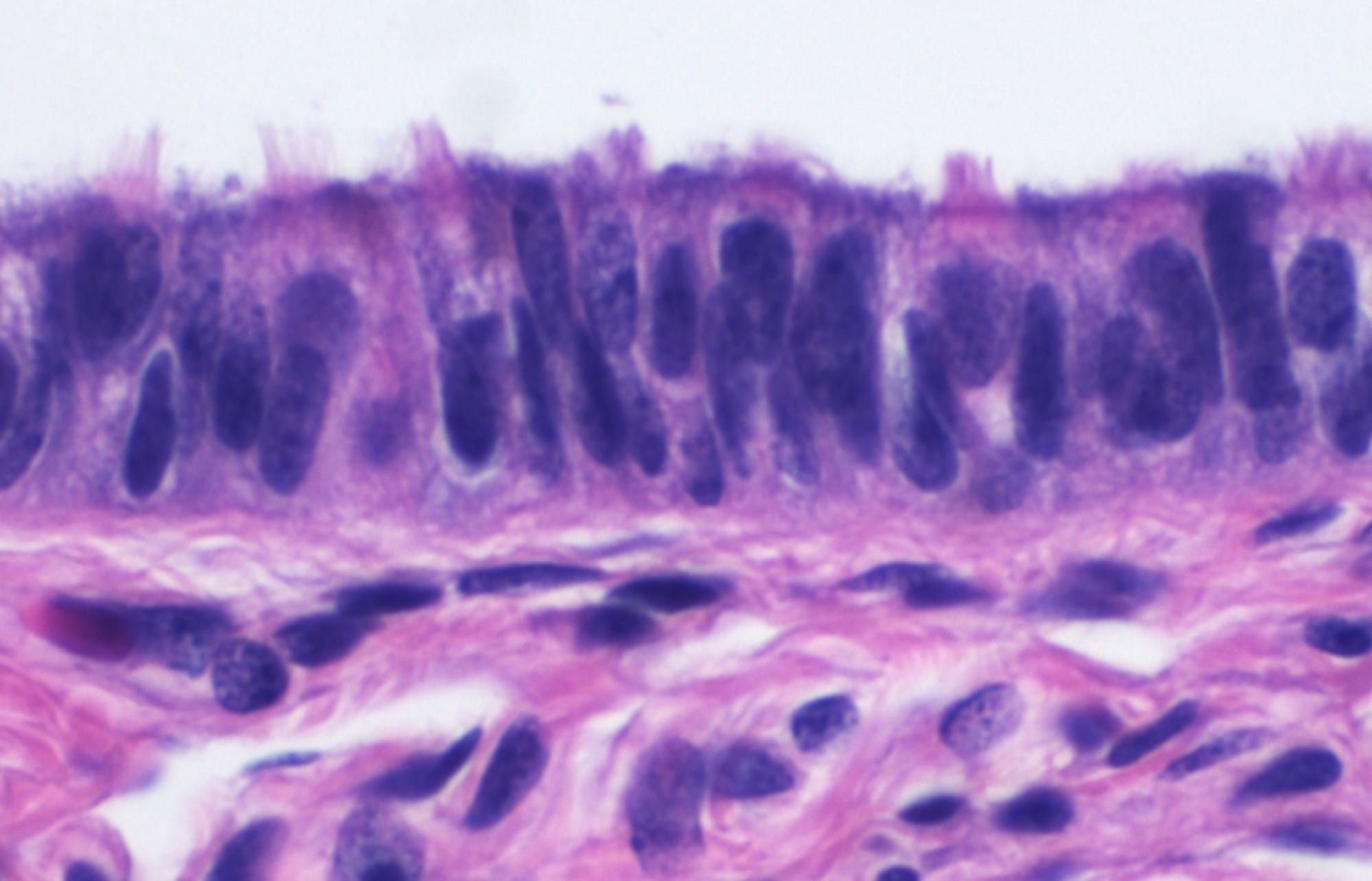 Secțiune microscopică colorată în roz și violet prin epiteliul ciliat al trompei uterine
