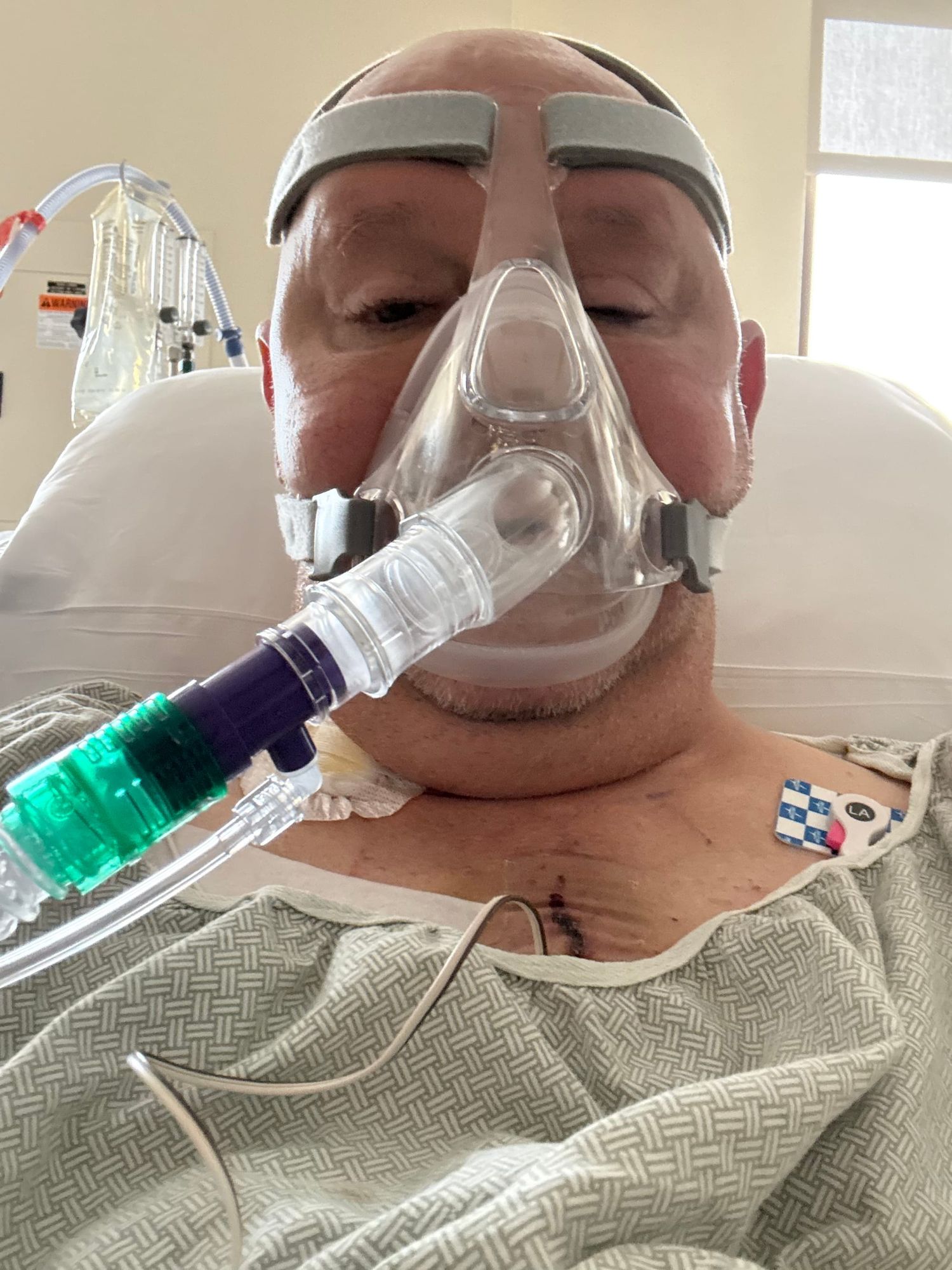 Triple Bypass