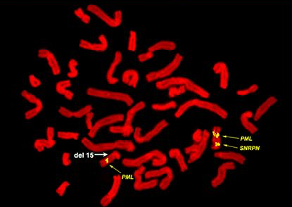 Genomics of rare diseases: success, opportunity and challenge