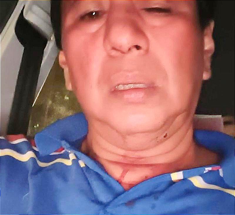 No supo ni por donde... ¡NOQUEAN A MANOLO! -Le rompen la nariz al periodista y abogado *Y se fue sin cenar
