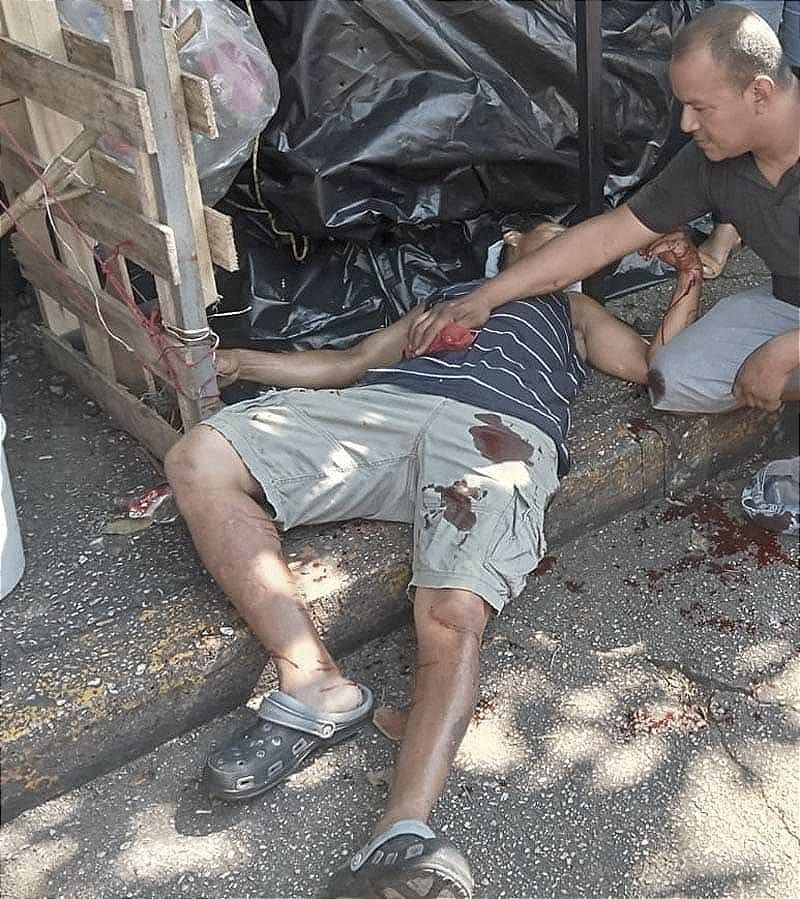 ¡TIROTEAN A UN FRANELERO EN EL MERCADO MORELOS DE COATZACOALCOS! -ALFREDO RECIBIO 4 BALAZOS Y EL AGRESOR ESCAPO
