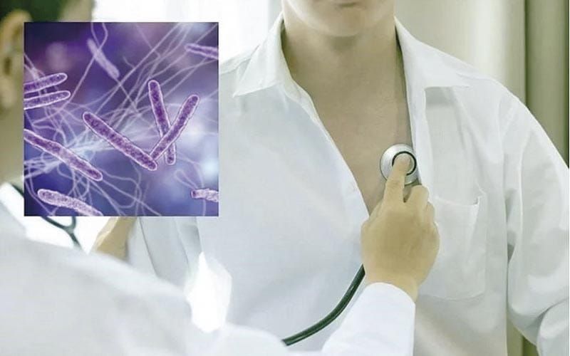 ¡SUMAN 4 MIL 113 CASOS DE TUBERCULOSIS EN MÉXICO!