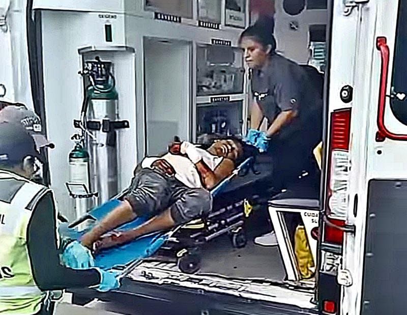 ¡MACHETEAN A “EL CHILUDO” Y CASI LO DEJAN SIN MANOS!