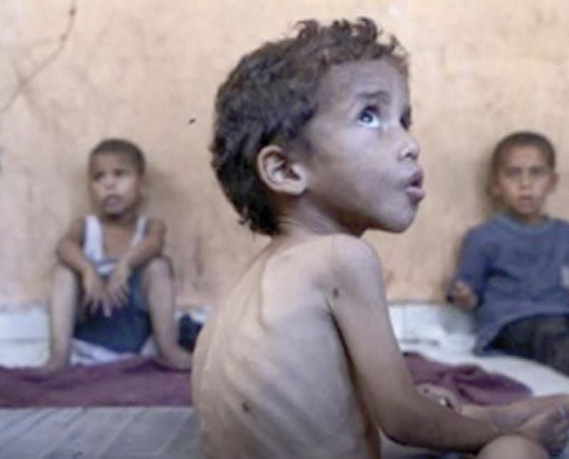 ¡GAZA SE MUERE DE HAMBRE! - ONU