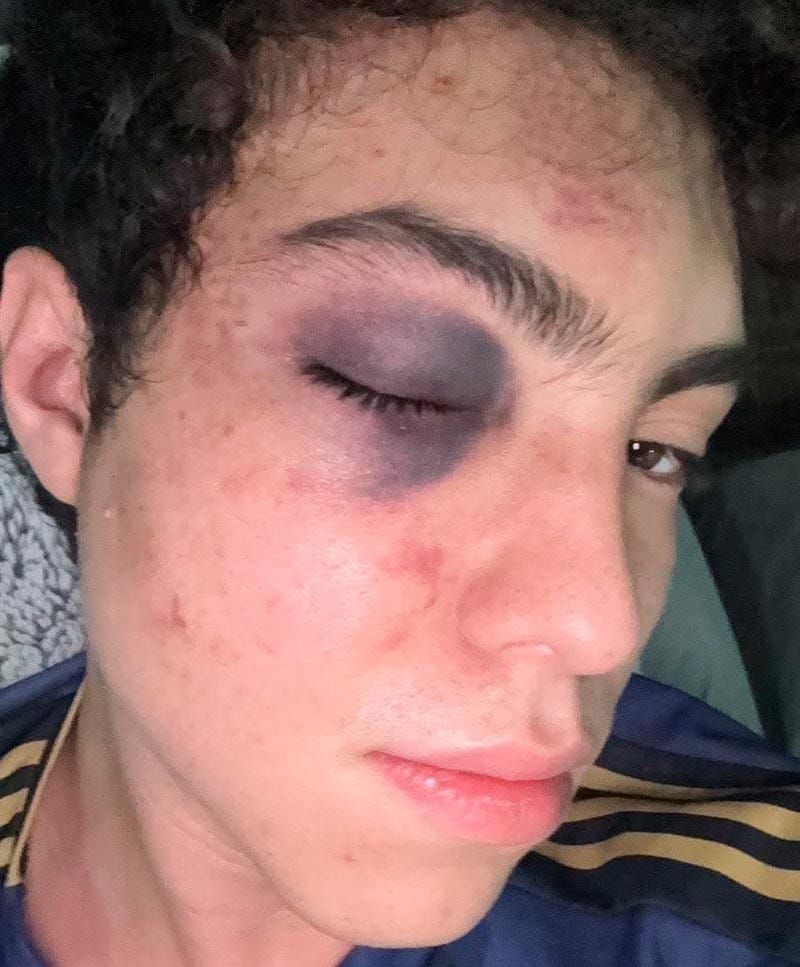 ¡NOQUEAN A ACTOR DE DOBLAJE EN EL WTC DE BOCA DEL RÍO! - DIJO QUE SU COPA ESTABA “BUENA” Y FUE GOLPEADO POR UN HOMBRE QUE PASABA CON SU NOVIA