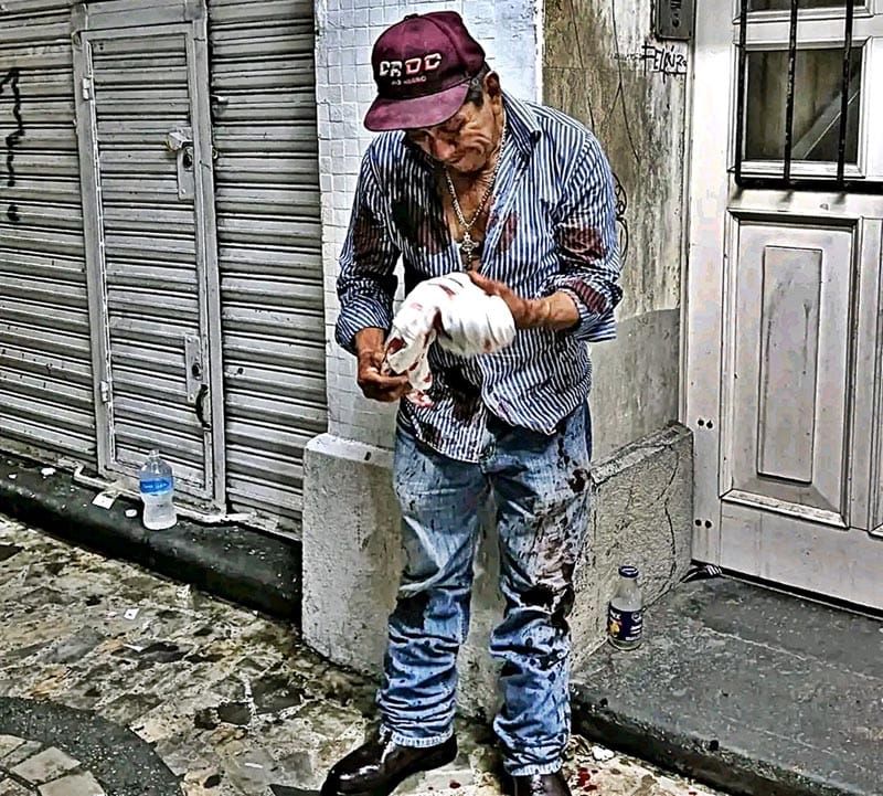 ¡ABUELITO ACUCHILLADO EN EL PARQUE ZAMORA!