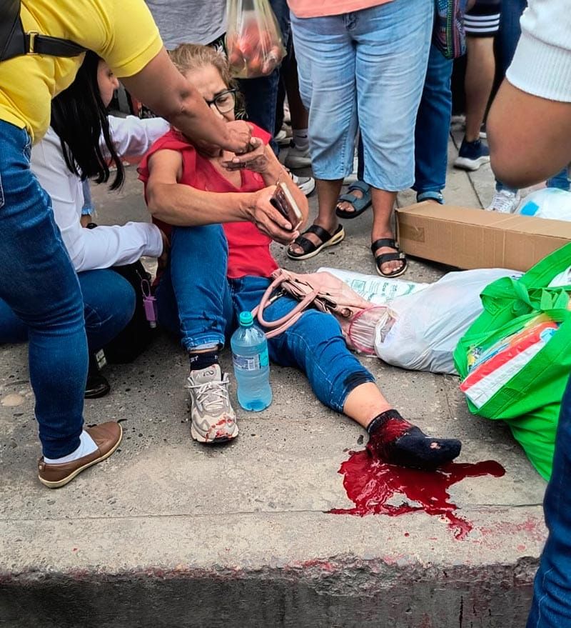 ¡ABUELITA SUFRE FRACTURA EN EL PIE ATROPELLADA POR AUTOBÚS ADO!