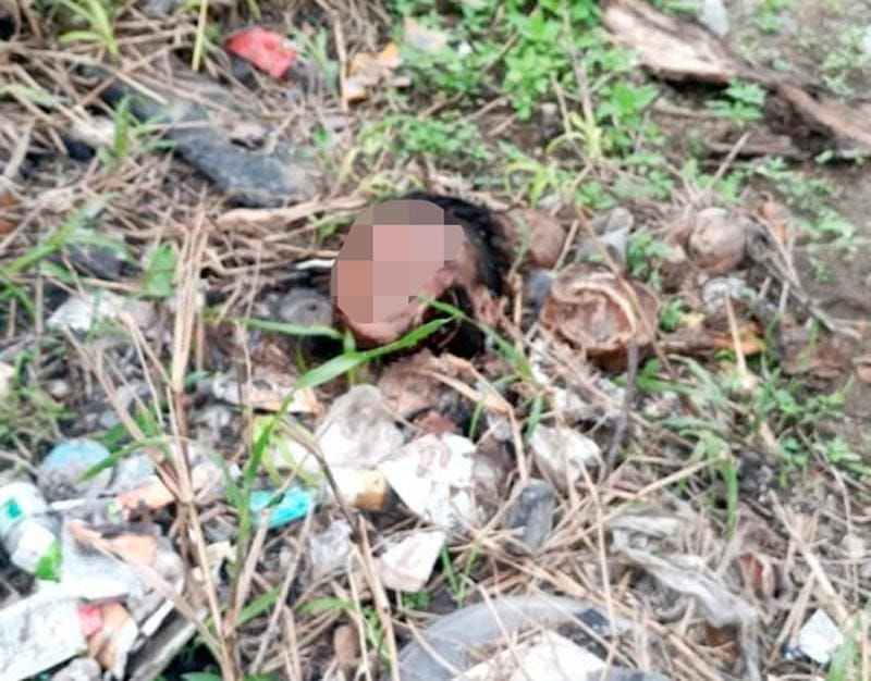 ¡DEJAN CABEZA HUMANA BAJO EL PUENTE CARACOL!