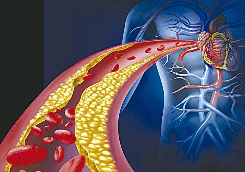 ¡HÁBITOS SALUDABLES PARA PREVENIR EL COLESTEROL Y LOS TRIGLICÉRIDOS ELEVADOS!