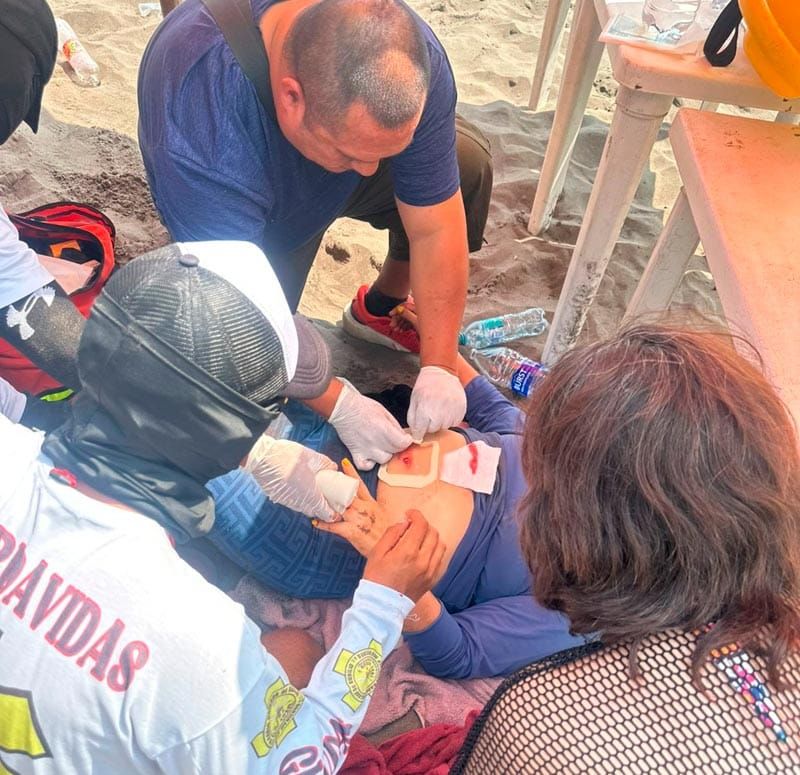 ¡TRES BALEADOS EN LA PLAYA! - PISTOLEROS ATACARON A COMERCIANTE Y VARIOS DISPAROS IMPACTARON A DOS TURISTAS