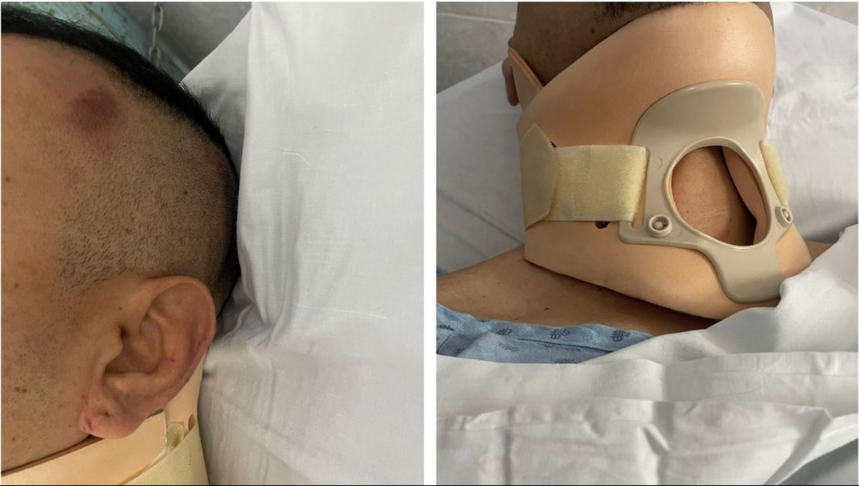 ¡AGENTES DE LA FISCALÍA DE GUANAJUATO PROPINAN GOLPIZA A REPORTERO EN JUVENTINO ROSAS!