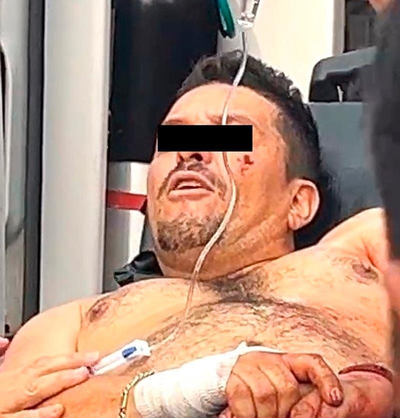 ¡ATACAN A BALAZOS AL GANADERO JUAN ‘LOCO’ EN ACAYUCAN!
