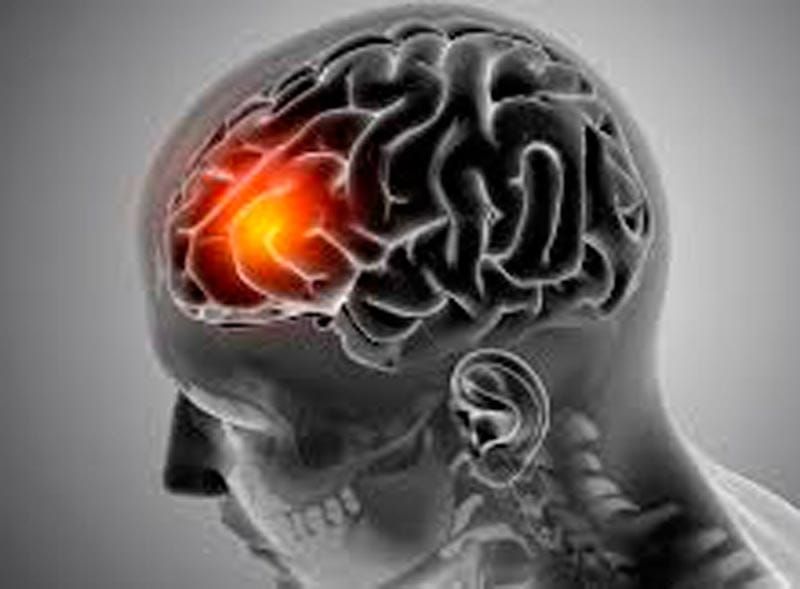 TIPS PARA MEJORAR TU CALIDAD DE VIDA | ICTUS - Un ictus, también conocido como accidente cerebrovascular (ACV) o ataque cerebral, ocurre cuando se interrumpe el flujo sanguíneo a una parte del cerebro, ya sea por un bloqueo o una hemorragia. Esta…