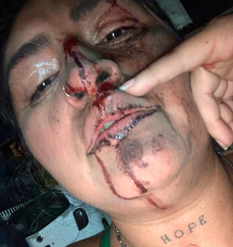 ¡“EL FIRE” ATACÓ A INGRID!
