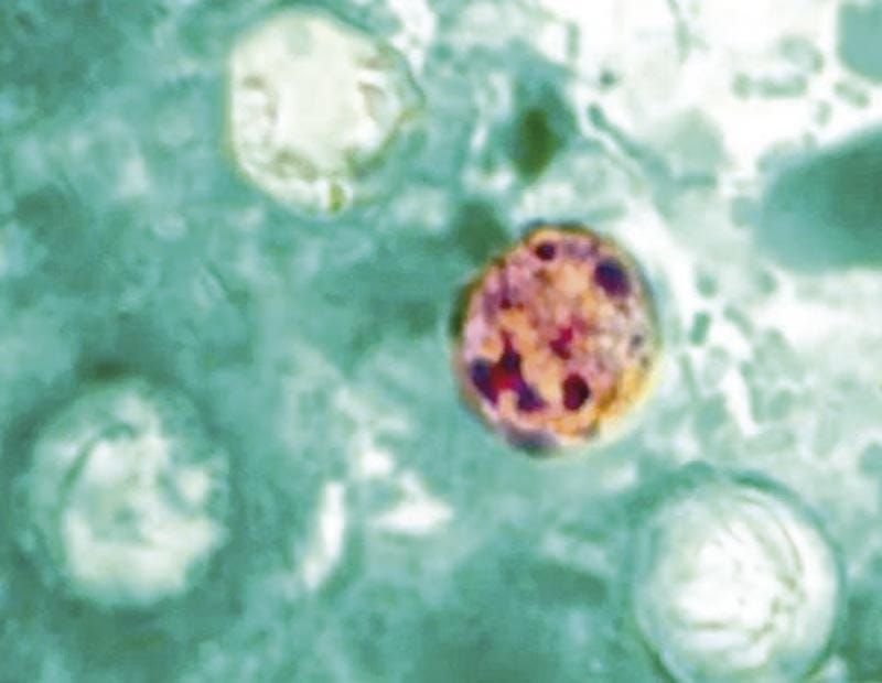 ¡MUEREN DOS PERSONAS EN MICHIGAN POR BROTE DE CICLOSPORIASIS!