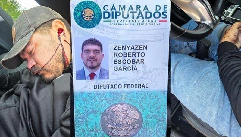 ¡ERA DERECHO! - Y NO ZURDO...