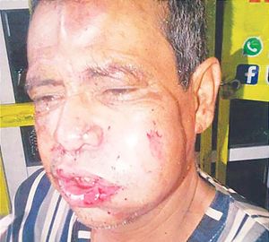 ¡ASALTAN Y GOLPEAN A MACUMBA!