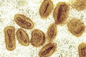 ¡EU REPORTA PRIMER CONTAGIO DE NUEVO TIPO DE VIRUELA SÍMICA EN VIAJERO!