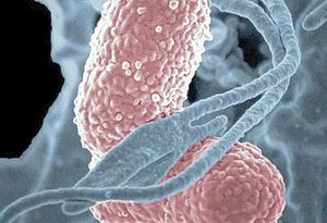 ¡TRECE NIÑOS MUEREN POR BROTE DE LA BACTERIA KLEBSIELLA OXYTOCA!